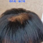 レディースウィッグ増毛