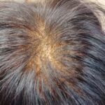 レディースウィッグ 薄いタイプ レディースウィッグ 薄いタイプ